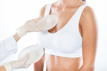 Breast enlargement surgery