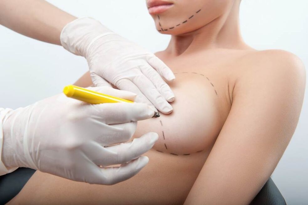 Method of operation