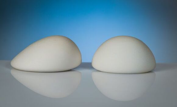 cohesive gel implants for breast augmentation